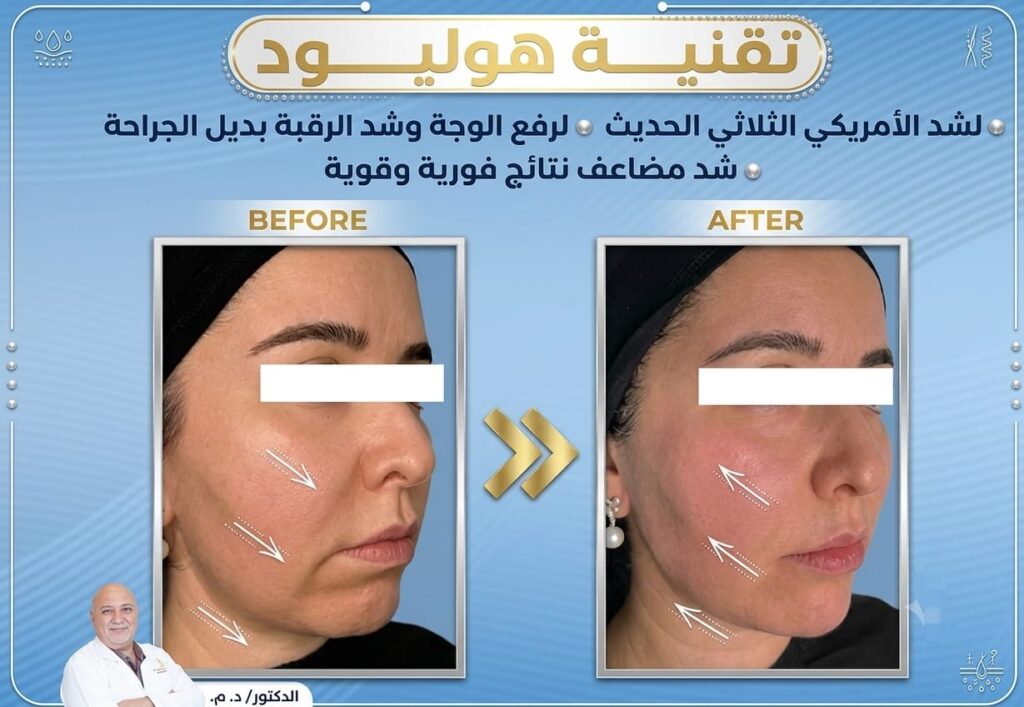 جلسات الليزر والتقنيات الحديثة للبشرة 3