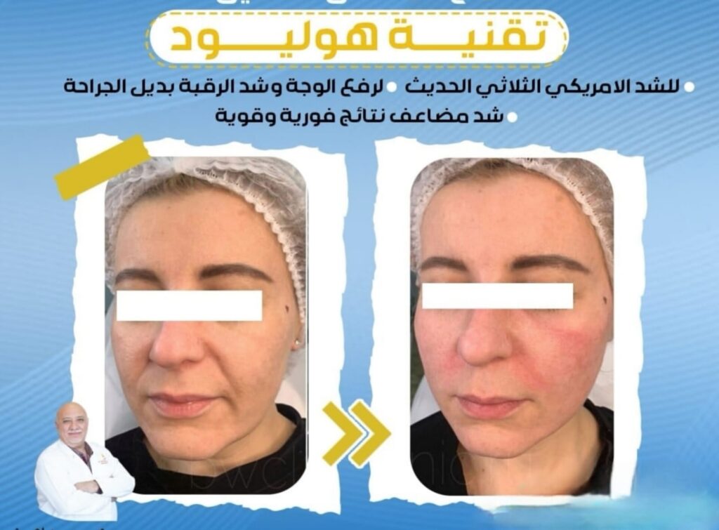 جلسات الليزر والتقنيات الحديثة للبشرة 2