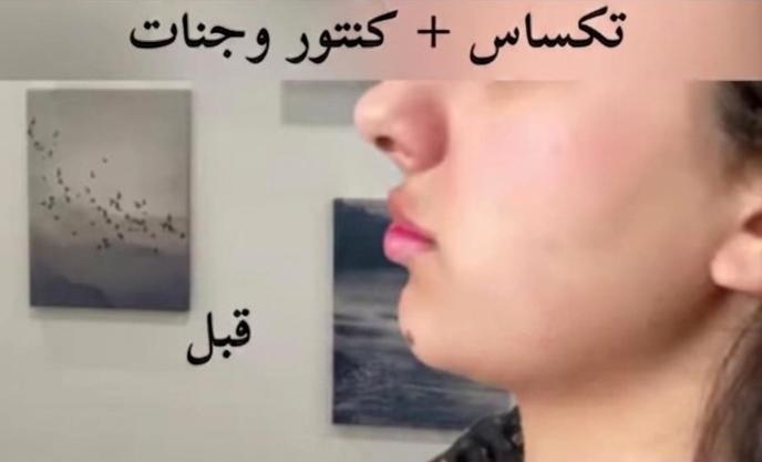 تحسين مظهر البشرة وتجديدها 1
