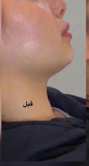 تحسين مظهر البشرة وتجديدها 4