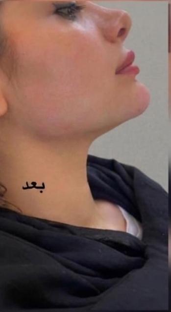 تحسين مظهر البشرة وتجديدها 3